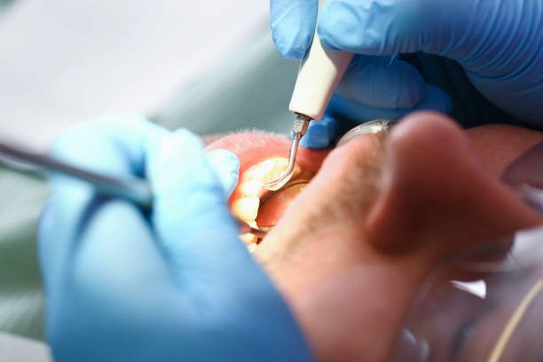 Best Knocked-Out Tooth Emergency  in Raoul, GA
