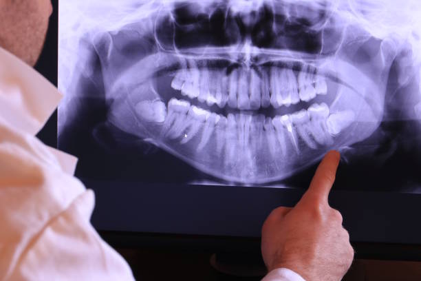 Best Dentist for Tooth Abscess  in Raoul, GA